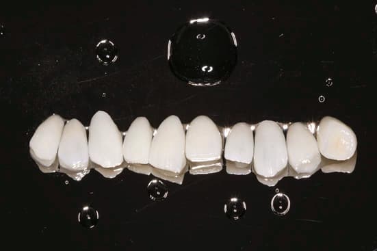 Odontologia Estética na Odonto J. Digital