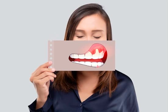 Periodontia na Odonto J. Digital